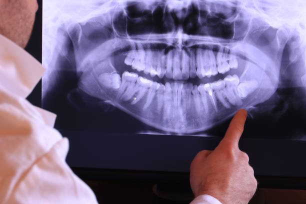 Best Urgent Tooth Repair  in Pickens, SC
