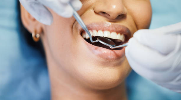 Dentist for Dental Trauma in SC